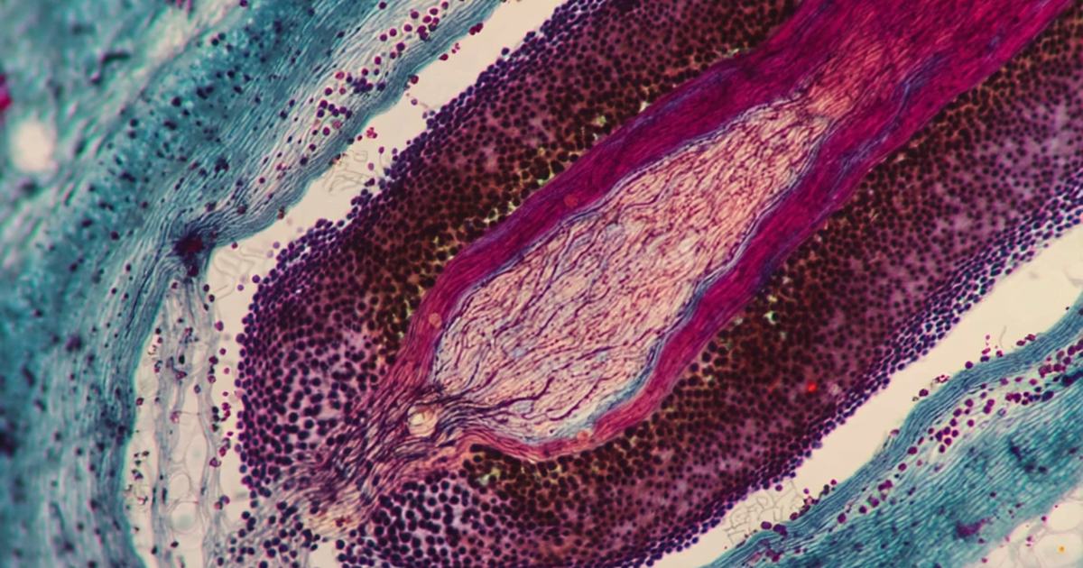 Illustration façon coupe microscopique d'un follicule pileux et des tissus qui l'entourent