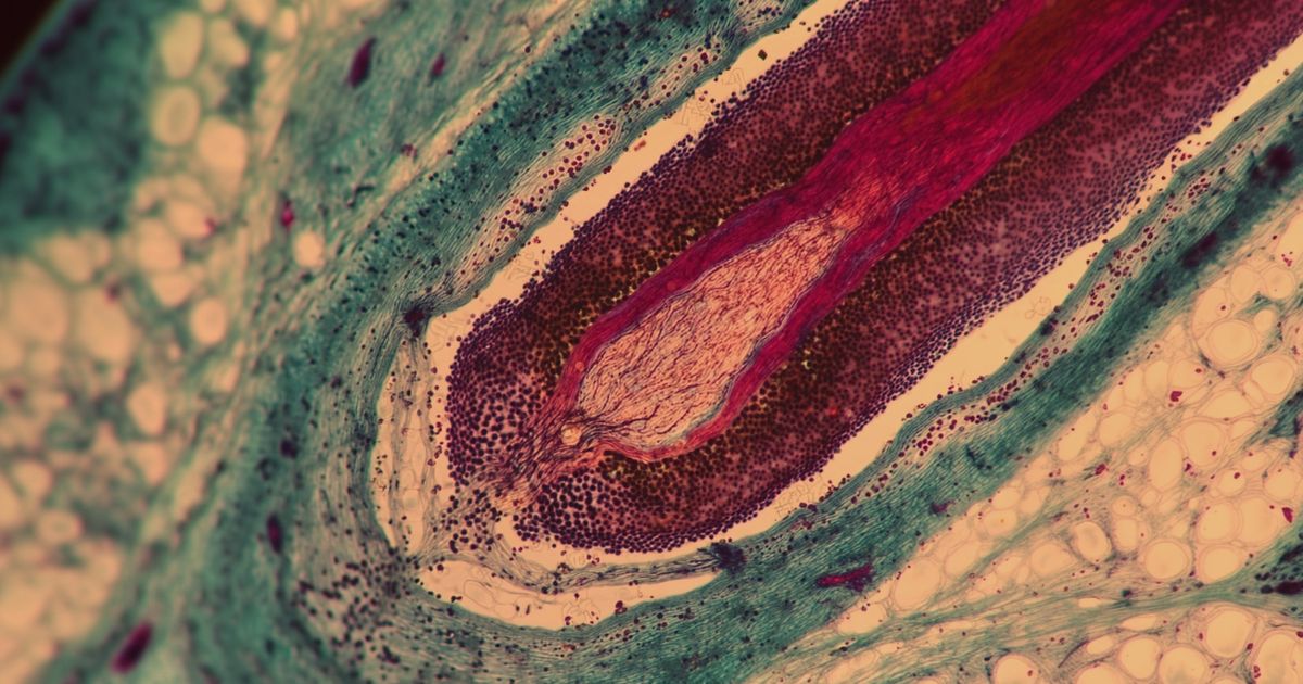 Coupe histologique d'un follicule pileux : le Redensyl cible les cellules souches du bulbe