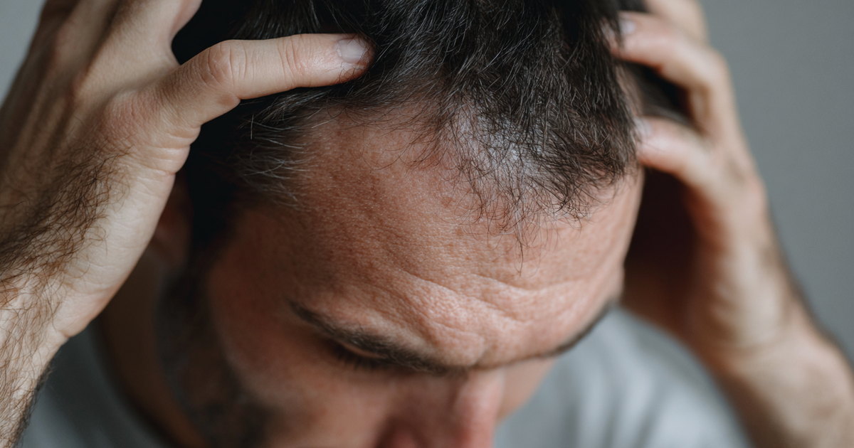Homme stressé, les mains dans les cheveux, la lisière frontale légèrement dégarnie